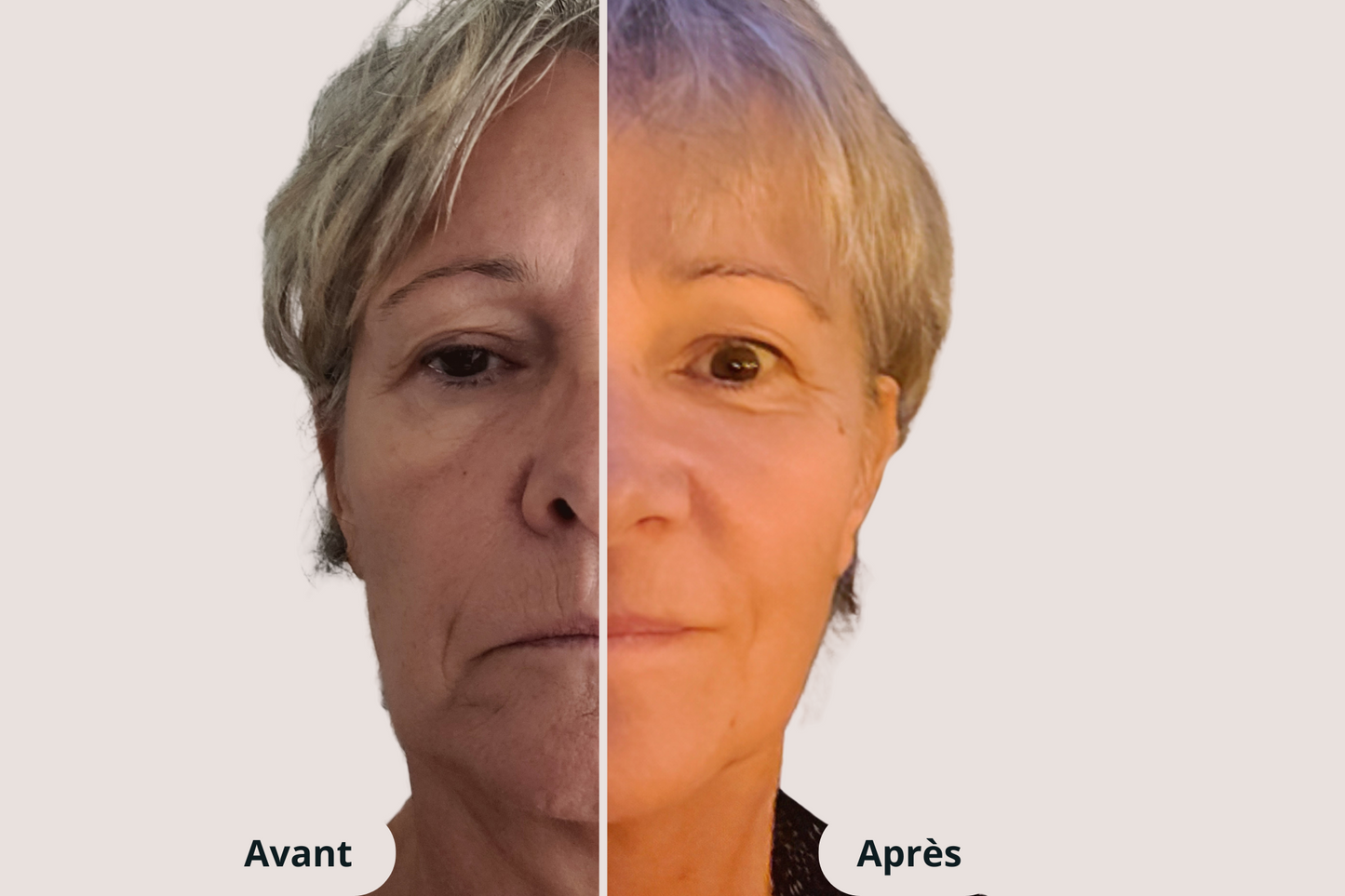 💕 Offre Duo Collagène – Prenez soin de vous en double !