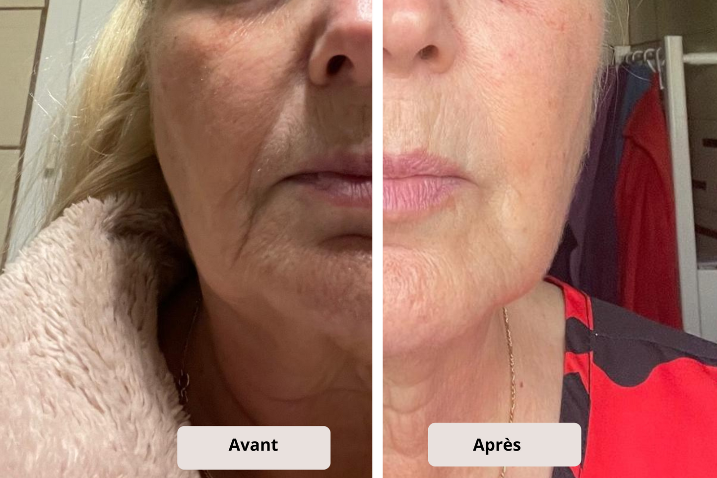 💕 Offre Duo Collagène – Prenez soin de vous en double !